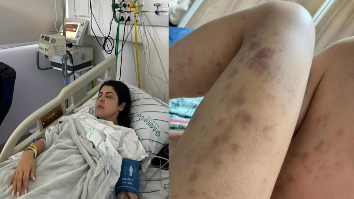 “Vi a morte”, relata advogada após procedimento feito por nutrólogo de Bolsonaro